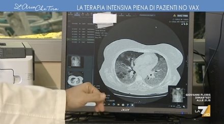 RIVOLI - Covid, la rabbia del dottor Grio: «95% dei letti di terapia intensiva occupato da no vax»