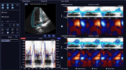 RIVOLI-VENARIA - La diagnosi in ospedale diventa tutta digitale: progetto da 16 milioni di euro
