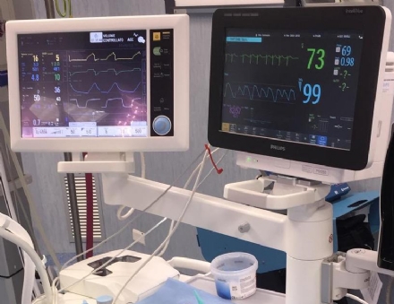 RIVOLI - Nuove strumentazioni salva-vita in sala operatoria, in Anestesia e in Rianimazione